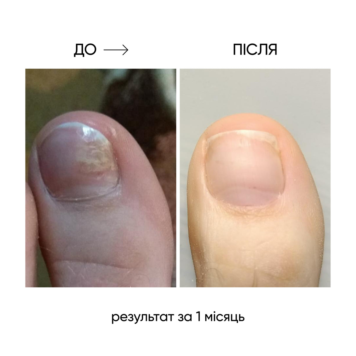NAILSOFTHEDAY ONISTOP – регенеруюча олія проти оніхолізису, 15 мл